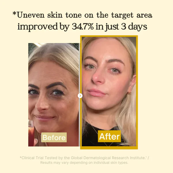 Medicube Turmeric Kojic Acid Night Mask