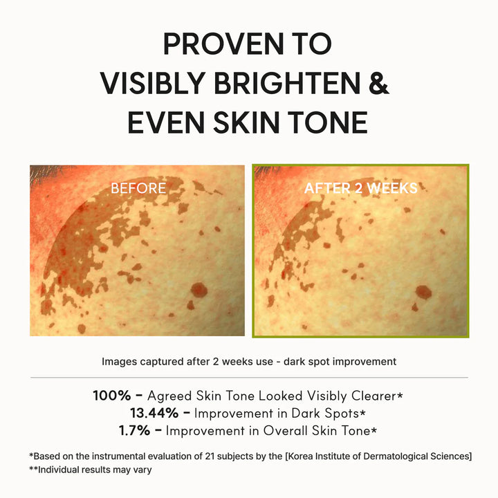 💗LAST DAY - BUY 2 GET 1 FREE Vitamin C Booster Shot, Pure Vitamin C + Glutathione for Bright, Healthy Skin Glow, 1.01 fl oz