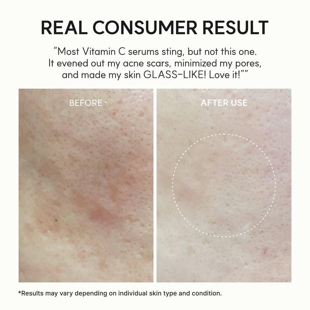 💗LAST DAY - BUY 2 GET 1 FREE Vitamin C Booster Shot, Pure Vitamin C + Glutathione for Bright, Healthy Skin Glow, 1.01 fl oz
