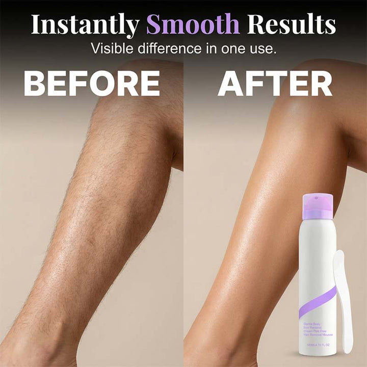 KLENIMORE ™  Gentle &amp; Painless Hair Removal Cream Duo for Sensitive Skin