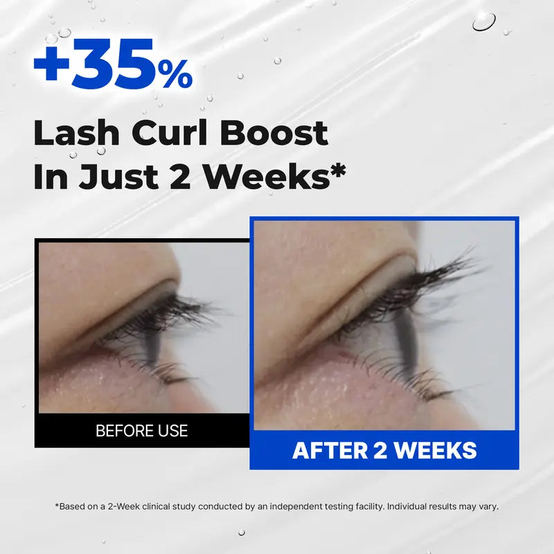 🎁✨Essential Eyelash Growth Serum, Jumbo Size 0.5fl.oz - Safe &amp; Gentle Lashes Care, Fuller, Thicker in 2 Weeks, Non-Prostaglandin
