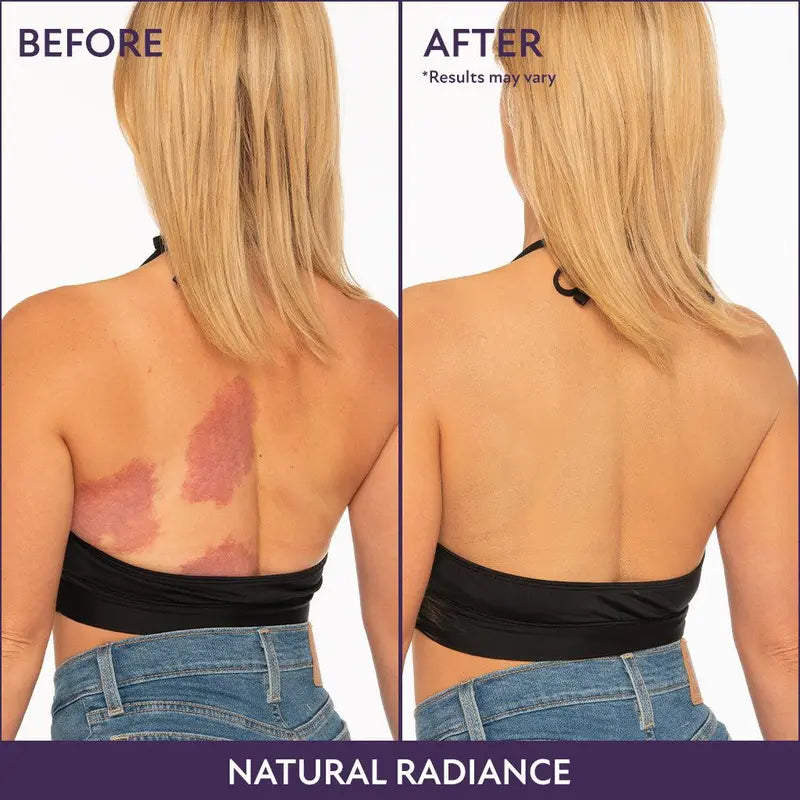 💜Last Day-Buy 1 Get 1 Free!💜✨Body Coverage Perfector – Waterproof, Lightweight &amp; Flawless Body Makeup