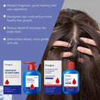 Selenium Disulfide Anti-dandruff Shampoo