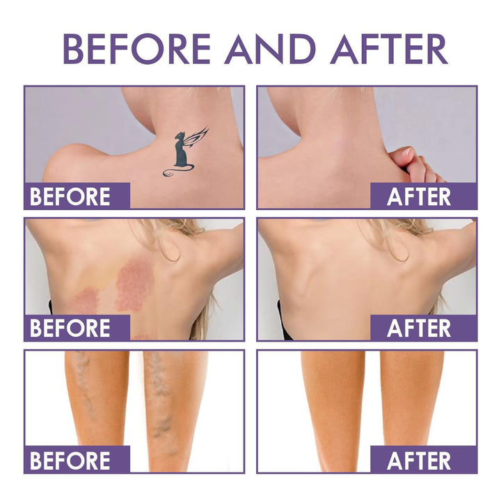 💜Ultimo giorno: acquista 1 e ricevi 1 in omaggio!💜✨Body Coveror Perfector – Impermeabile e leggero &amp;  Trucco corpo impeccabile