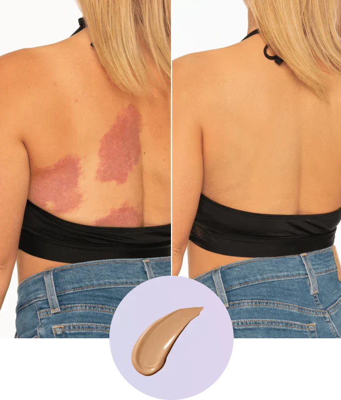 💜Ultimo giorno: acquista 1 e ricevi 1 in omaggio!💜✨Body Coveror Perfector – Impermeabile e leggero &amp;  Trucco corpo impeccabile