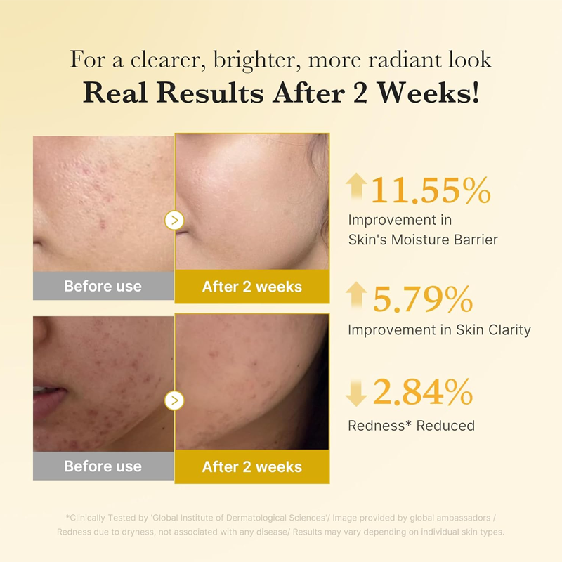 Kojic Acid Turmeric Power Duo for Face &amp; body | Ideal for Troubled Skin &amp; Use After Spot Care | Soothing &amp; Calming with Kojic Acid, Turmeric, Niacinamide