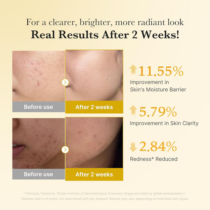 Kojic Acid Turmeric Power Duo for Face &amp; body | Ideal for Troubled Skin &amp; Use After Spot Care | Soothing &amp; Calming with Kojic Acid, Turmeric, Niacinamide