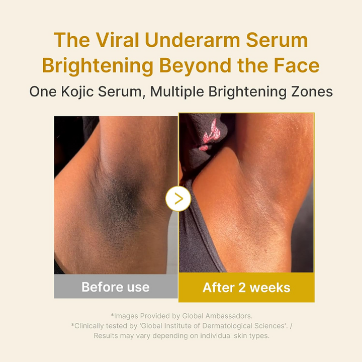 Kojic Acid Turmeric Power Duo for Face &amp; body | Ideal for Troubled Skin &amp; Use After Spot Care | Soothing &amp; Calming with Kojic Acid, Turmeric, Niacinamide