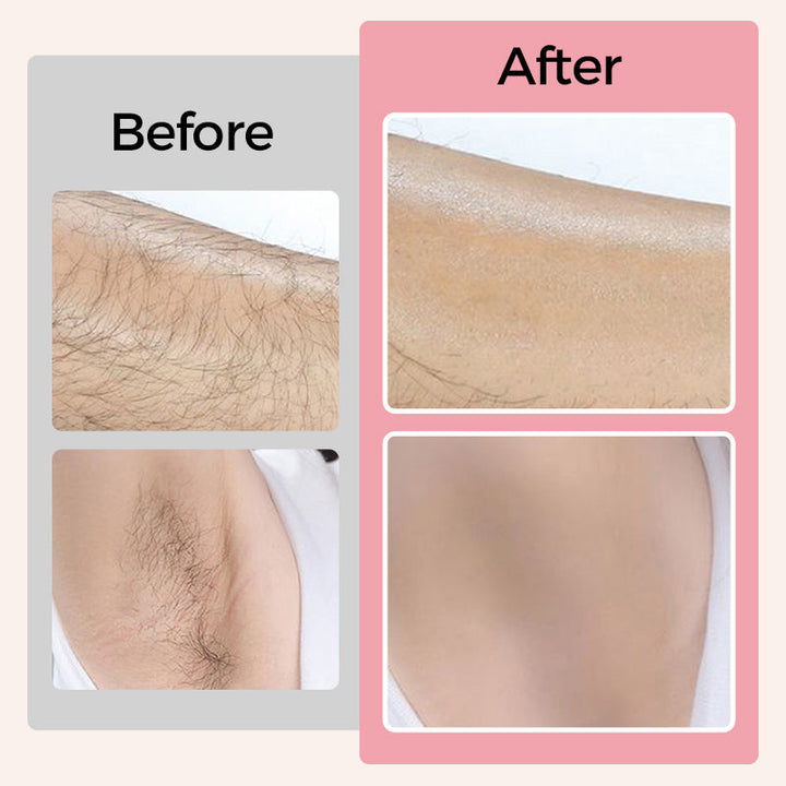 Cleansing &amp; Softening Hair Removal Cream Set