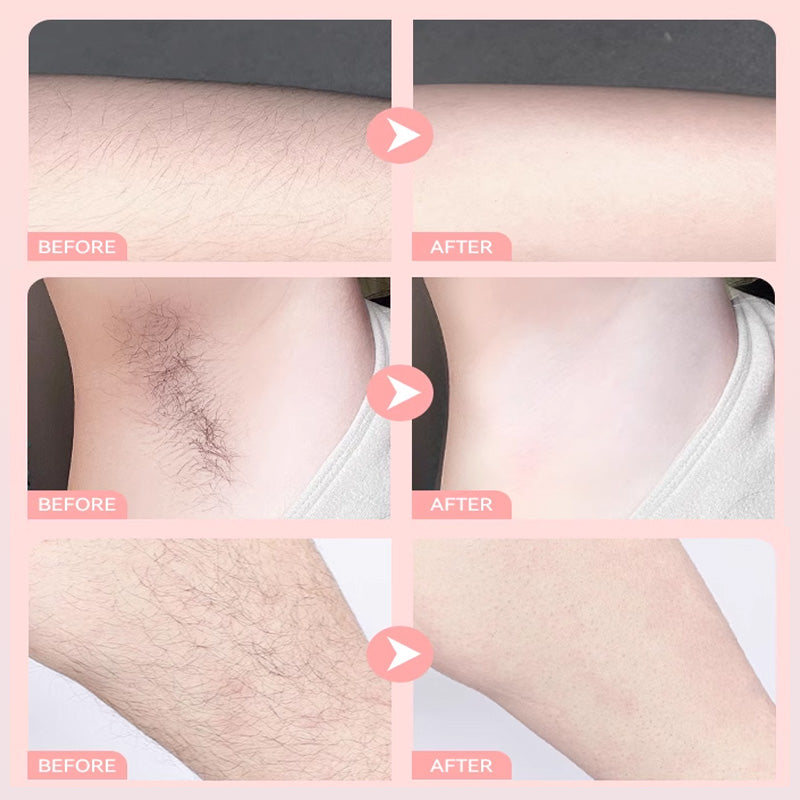 🎉Summer Hot Sale🎉Convenient Gentle Hair Removal Cream