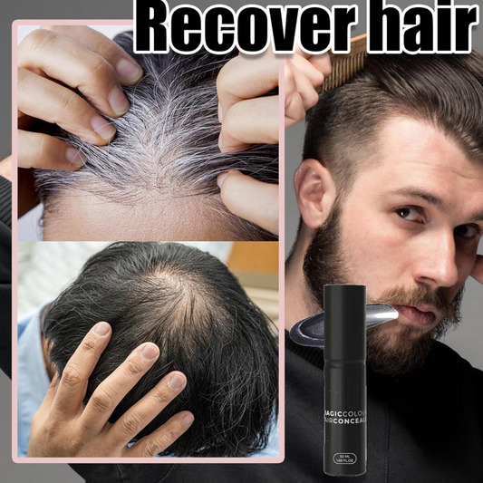 🔥LAST DAY PROMOTION - 50%OFF🔥Scalp Concealer for Fuller, Natural-Looking Hair