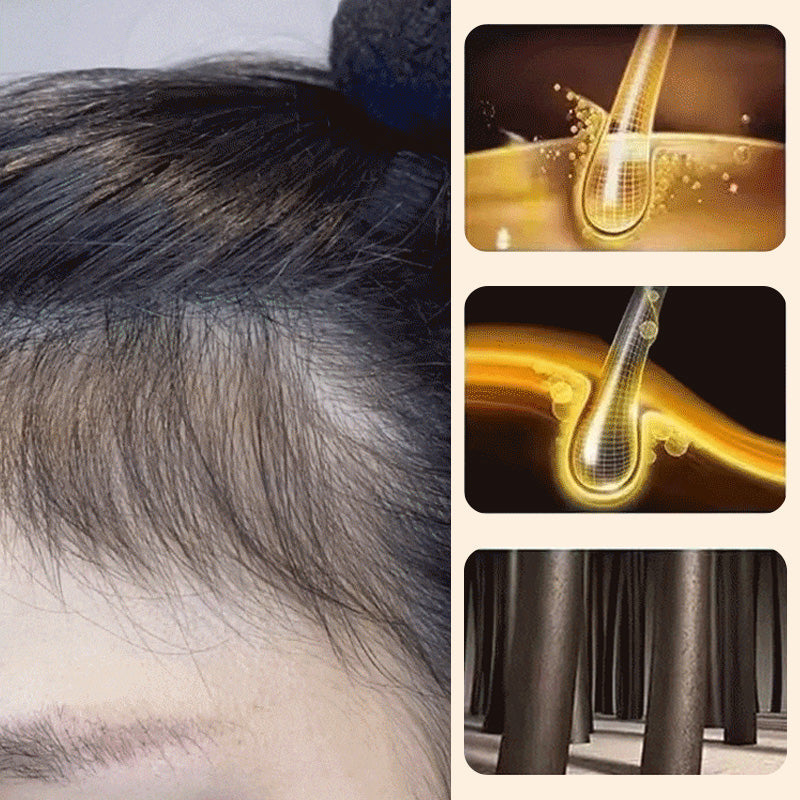 ☘️Polygonum Shampoo Soap, Cleansing Hair & Face